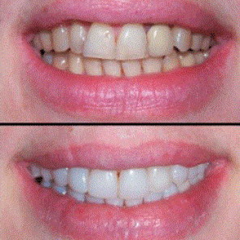 Фото з портфоліо клініки НормаСтом (стоматологічна клініка, Харків)