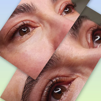 Міжвійка коричневим пігментом