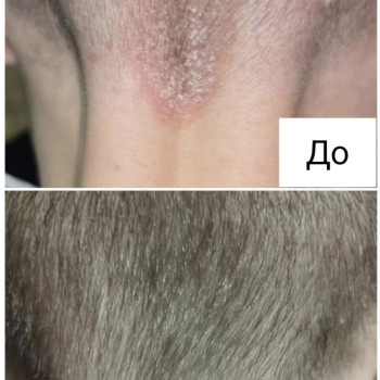 Фото з портфоліо косметолога Ганна Філоненко (Кременчук)