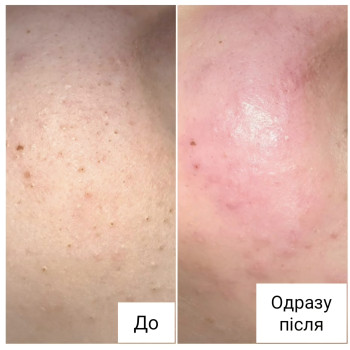 Фото з портфоліо косметолога Ганна Філоненко (Кременчук)