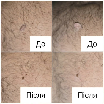 Фото з портфоліо косметолога Ганна Філоненко (Кременчук)