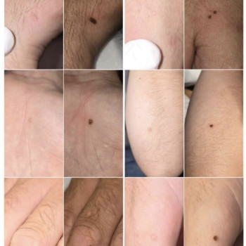 Фото з портфоліо косметолога Ганна Філоненко (Кременчук)