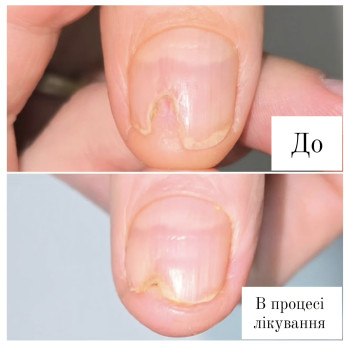 Фото з портфоліо косметолога Ганна Філоненко (Кременчук)