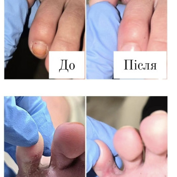 Фото з портфоліо косметолога Ганна Філоненко (Кременчук)