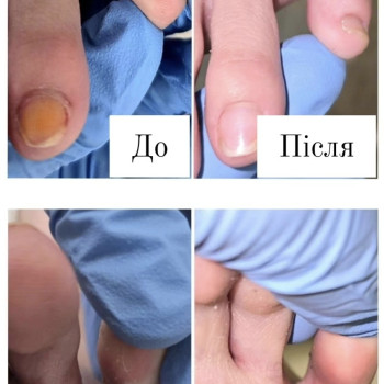 Фото з портфоліо косметолога Ганна Філоненко (Кременчук)