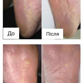 Фото з портфоліо косметолога Ганна Філоненко (Кременчук)