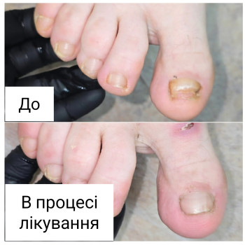 Фото з портфоліо косметолога Ганна Філоненко (Кременчук)