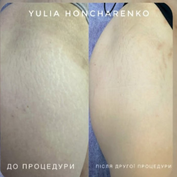 Фото с портфолио Юлія Гончаренко