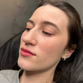 Збільшення Губ