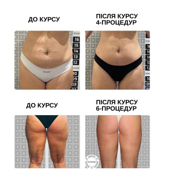 Фото с портфолио Inicio Clinic