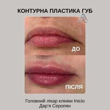 Фото с портфолио Inicio Clinic