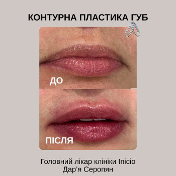 Фото с портфолио Inicio Clinic