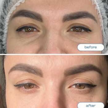 Фото с портфолио Beauty Smile