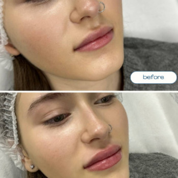 Фото с портфолио Beauty Smile