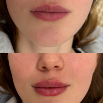 Фото с портфолио FP