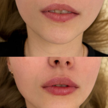 Фото с портфолио FP