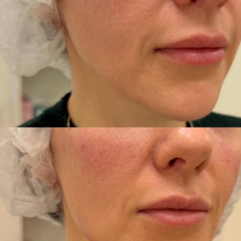 Фото с портфолио FP