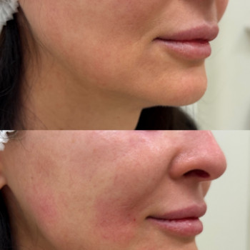 Фото с портфолио FP