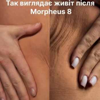 Фото с портфолио Наталья Кобец