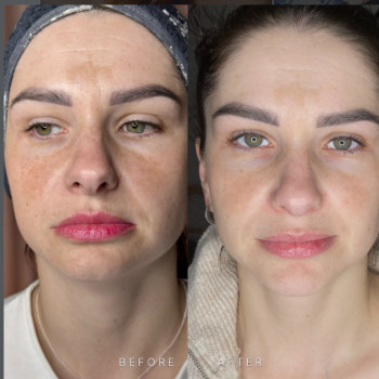 Фото с портфолио Наталья Кобец