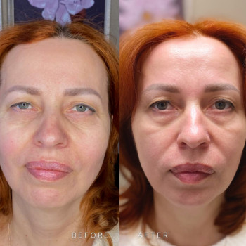 Фото с портфолио Наталья Кобец