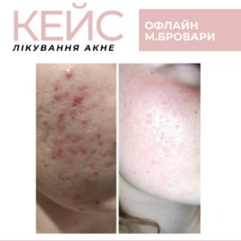 Фото с портфолио Наталья Олефир