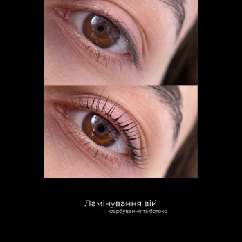 Фото с портфолио Діана Сливчук