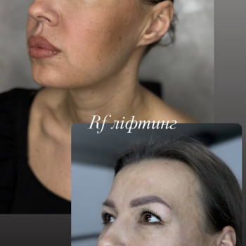 Фото с портфолио Наталя Курник