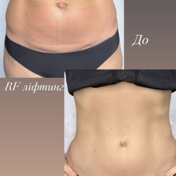 Фото с портфолио Наталя Курник