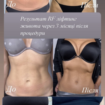 Фото с портфолио Наталя Курник