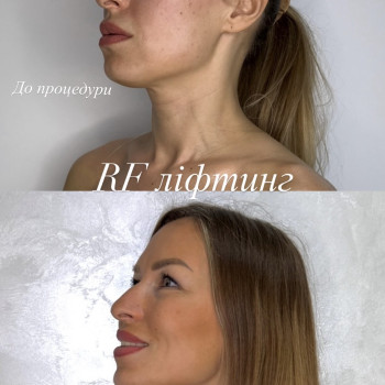 Фото с портфолио Наталя Курник