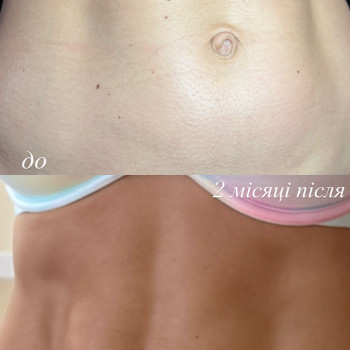 Фото с портфолио Наталя Курник