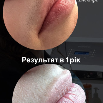 Дівчинка,має пушкове волосся,також працюємо з електро і бачимо гарну динаміку