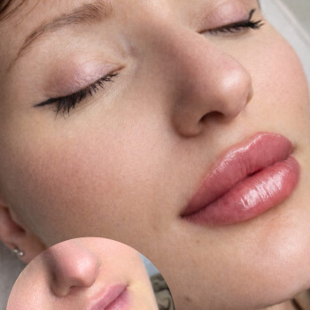 Фото с портфолио Тетяна Скрильник