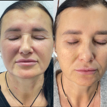 Фото с портфолио Тетяна Скрильник