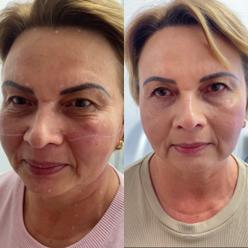 Фото с портфолио Тетяна Скрильник