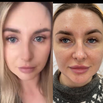 Фото с портфолио Тетяна Скрильник