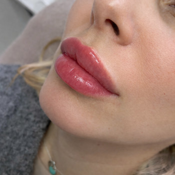 Фото с портфолио Тетяна Скрильник