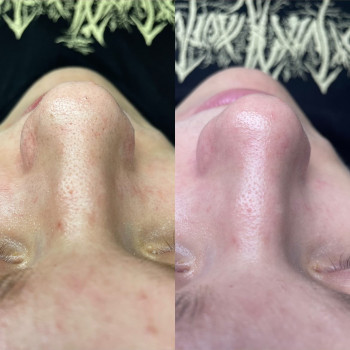 Фото с портфолио Тетяна Скрильник