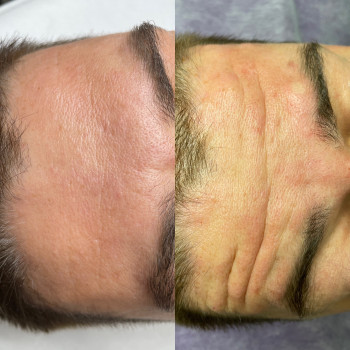 Фото с портфолио Тетяна Скрильник