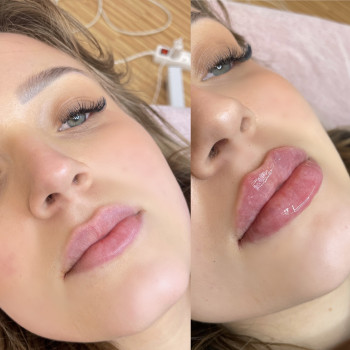 Фото с портфолио Тетяна Скрильник