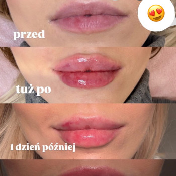 Фото с портфолио Тетяна Скрильник