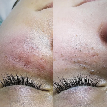 Фото с портфолио Тетяна Скрильник