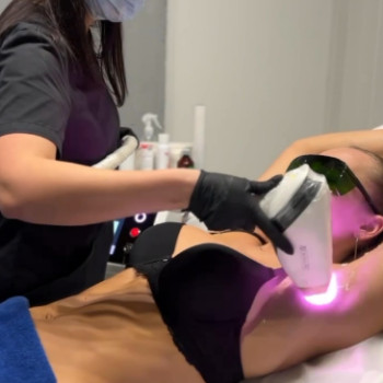 Фото с портфолио By Lace