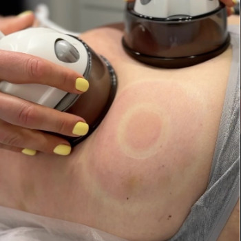 Фото с портфолио By Lace