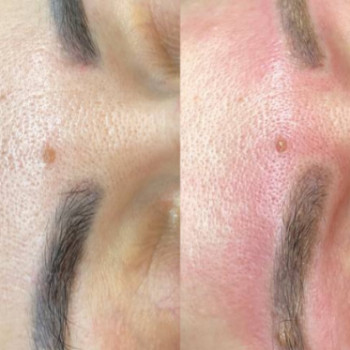 Фото с портфолио Lava