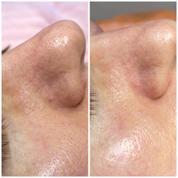 Фото с портфолио Ольга Мельник