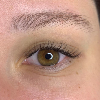 Класичне нарощення