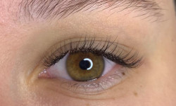 Класичне нарощення Лешмейкер  Киев