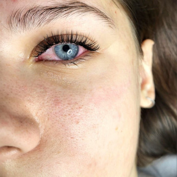 Антиплавна лінія